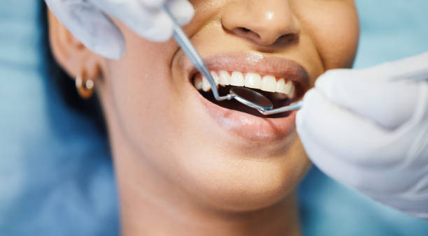 Best Dental Abscess Treatment in Spring Valley, IL